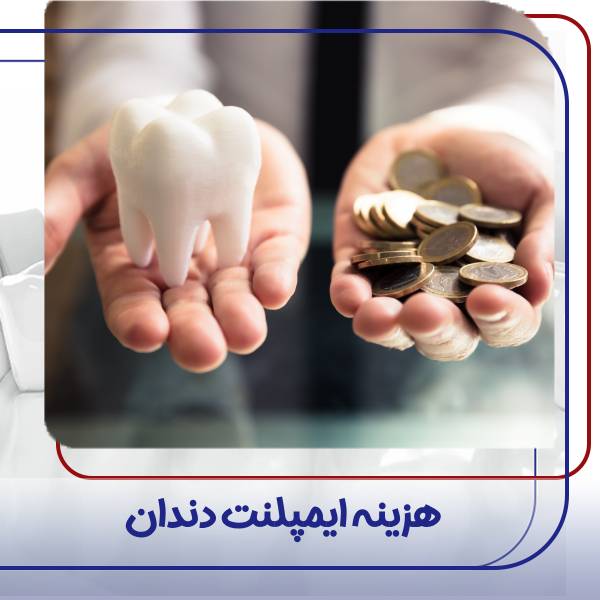 هزینه ایمپلنت دندان 1404