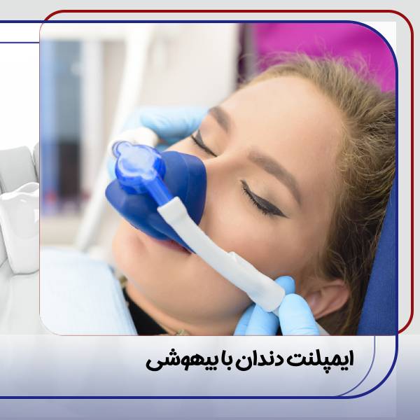 ایمپلنت دندان با بیهوشی