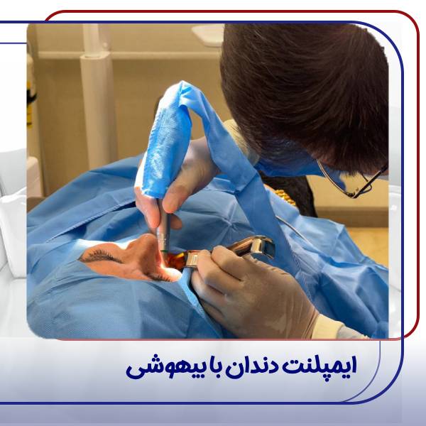 ایمپلنت دندان با بیهوشی