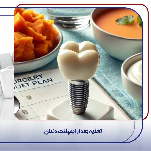 تغذیه بعد از ایمپلنت دندان