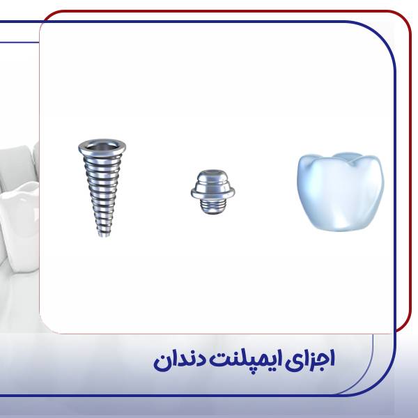 اجزای ایمپلنت دندان
