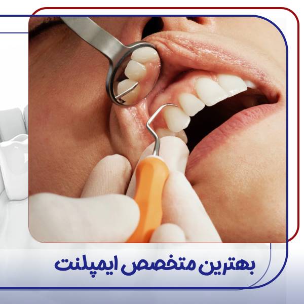بهترین متخصص ایمپلنت تهران