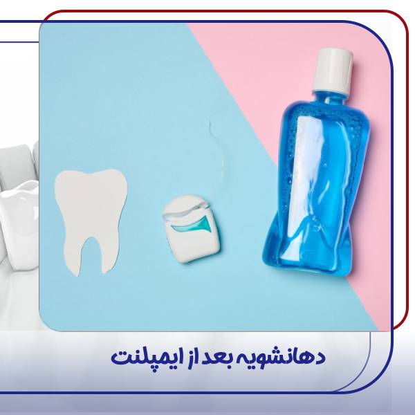 دهانشویه بعد از ایمپلنت