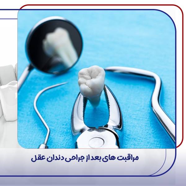 مراقبت های بعد از جراحی دندان عقل