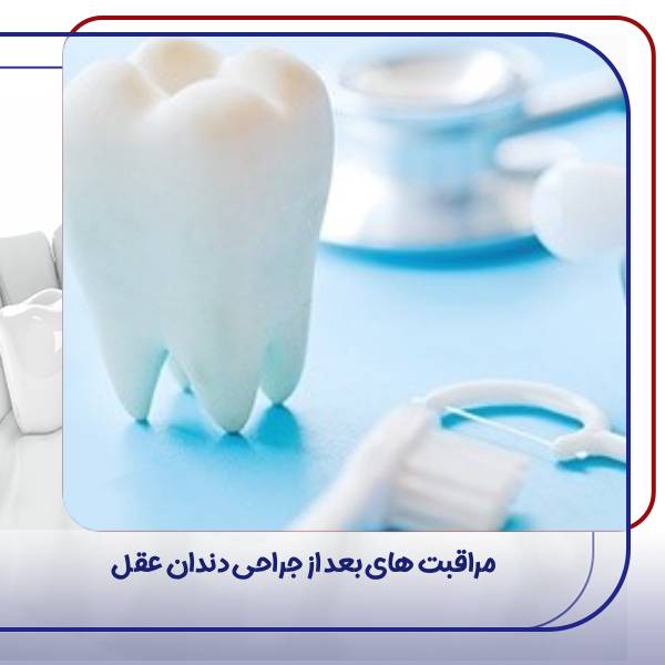 مراقبت های بعد از جراحی دندان عقل
