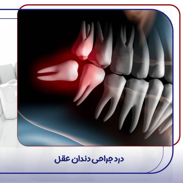 درد جراحی دندان عقل