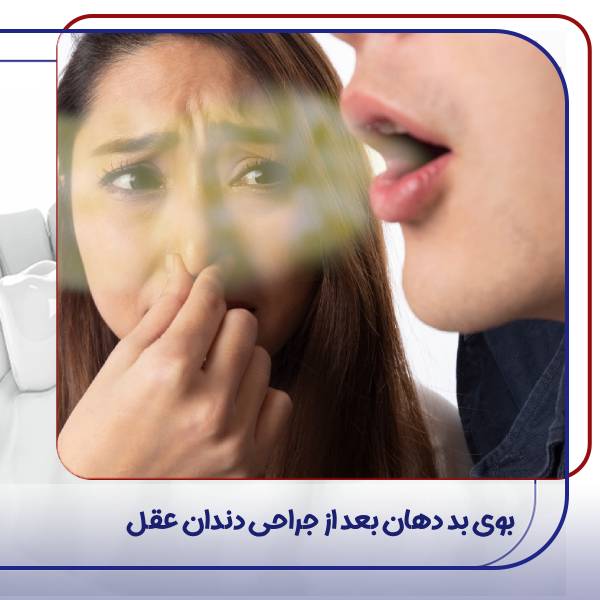 بوی بد دهان بعد از کشیدن دندان عقل