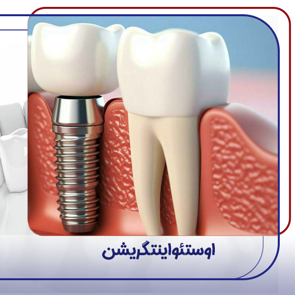 اوستئواینتگریشن